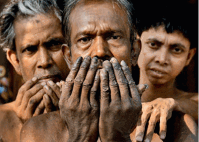 ARSENIC, a useful Toxin.